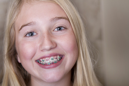 Young teen girl with braces on her teeth